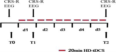 High-Definition Transcranial Direct Current Stimulation of the Dorsolateral Prefrontal Cortex Modulates the Electroencephalography Rhythmic Activity of Parietal Occipital Lobe in Patients With Chronic Disorders of Consciousness